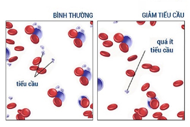 số lượng tiểu cầu