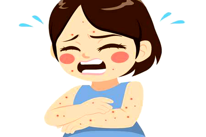 Bệnh ghẻ ngứa ở trẻ em