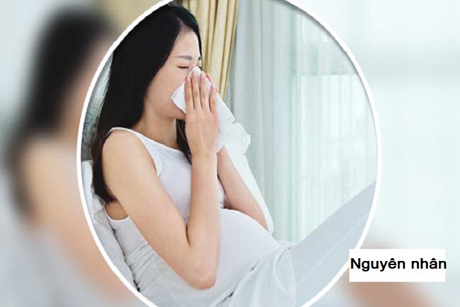 nguyên nhân gây bệnh