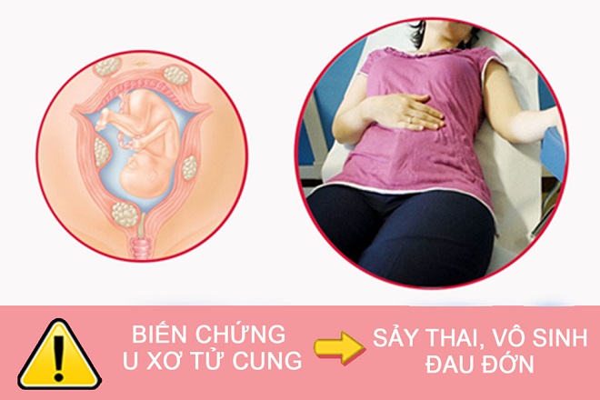 biến chứng bệnh