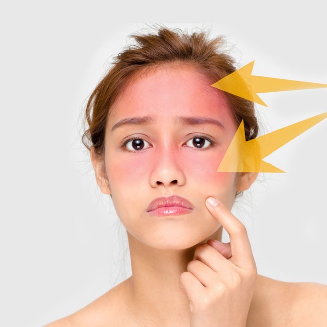 Da cần được bảo vệ khỏi ánh nắng và các tác động xấu để nhanh phục hồi