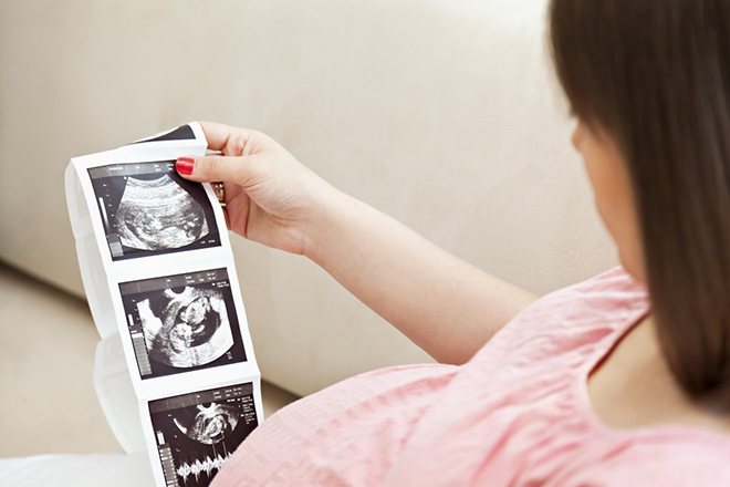 Mẹ xem kết quả siêu âm