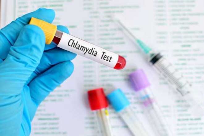 Bệnh Chlamydia