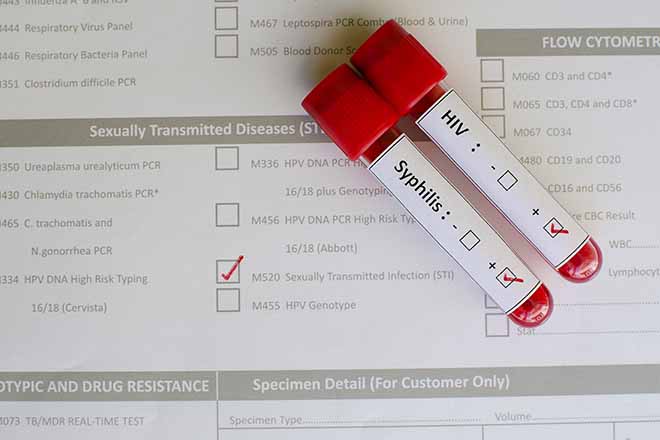Xét nghiệm HIV và STDs