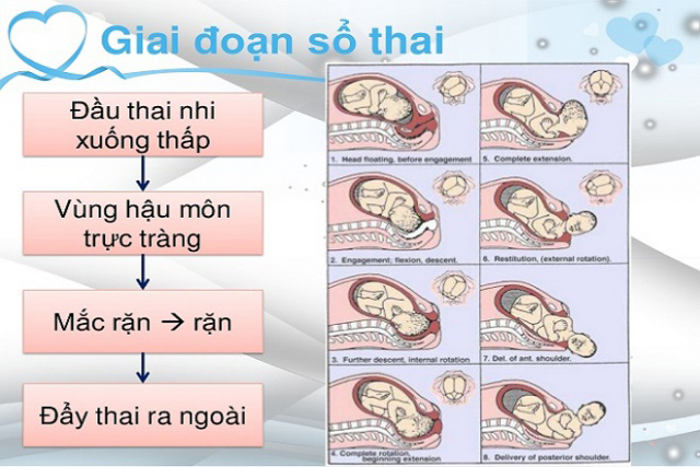Giai đoạn sổ thai nhi