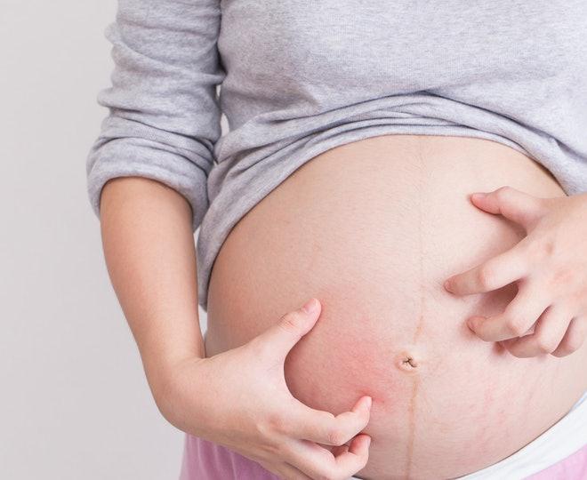 các vết ngứa trên vùng da