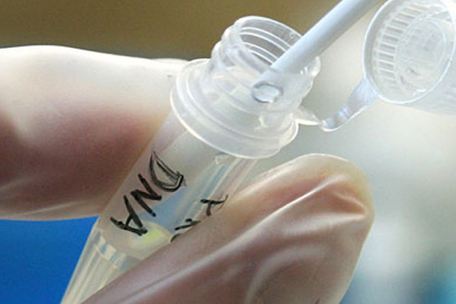 Xét nghiệm ADN bằng nước ối