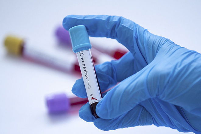 Xét nghiệm coronavirus