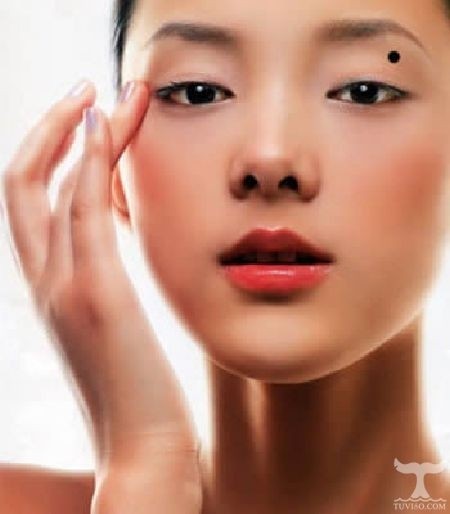Nốt ruồi khai vận mọc ở vị trí giữa mắt và lông mày