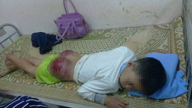 vu chau be bi bao hanh tai thai nguyen nguoi me va luat su noi gi 6.jpg