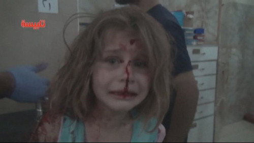 tieng goi bo oi xe long cua be gai syria voi khuon mat day mau sau vu no bom 5.jpg