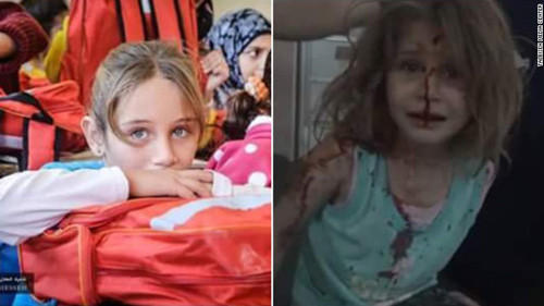 tieng goi bo oi xe long cua be gai syria voi khuon mat day mau sau vu no bom 4.jpg