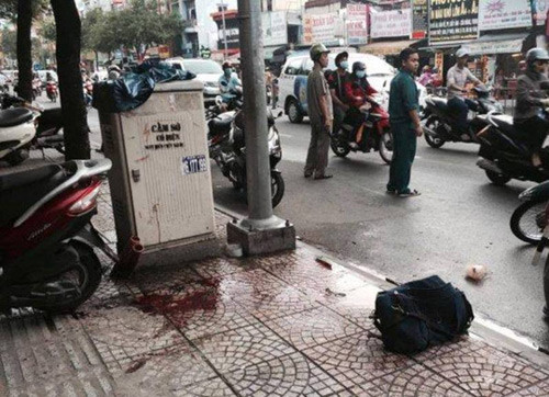 loi ke kinh hoang vu nguoi dan ong bi chem gan lia canh tay 1.jpg