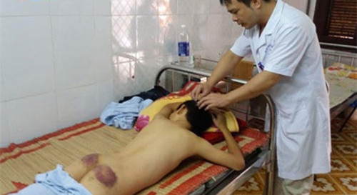 be-trai-12-tuoi-bi-me-ke-danh-trong-thuong-phai-nhap-vien-1.jpg