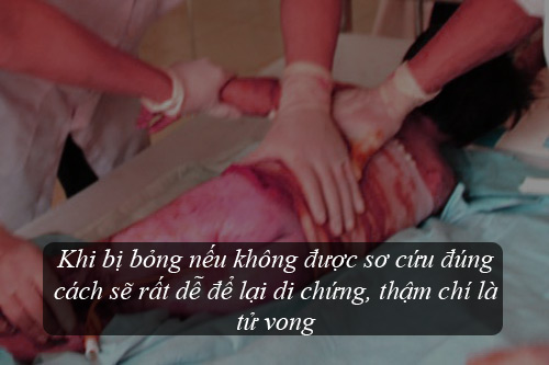 chuyen-gia-huong-dan-cach-so-cuu-don-gian-hieu-qua-khi-tre-bi-bong-bong2.jpg