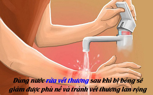 chuyen-gia-huong-dan-cach-so-cuu-don-gian-hieu-qua-khi-tre-bi-bong-bong3.jpg