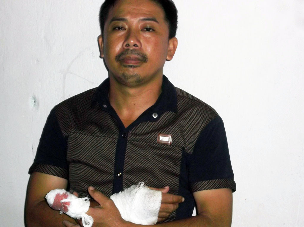 thay-vo-au-yem-ban-than-rut-dao-dam-chet-tinh-dich-1.jpg