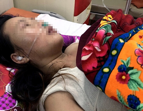 chong danh vo ton thuong so nao nhap vien cap cuu chongdanh1.jpg