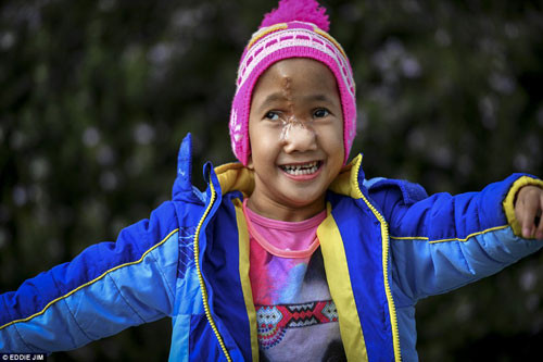 be-4-tuoi-bi-goi-la-quai-vat-da-thay-doi-cuoc-song-dieu-ky-sau-ca-phau-thuat-3a6b7d9c00000578-3940218-image-a-12_1479259588178.jpg