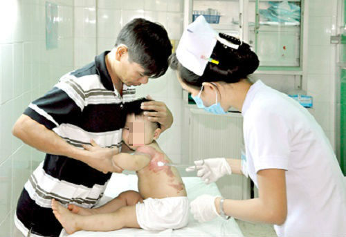 1479789226-bong-so-cuu.jpg