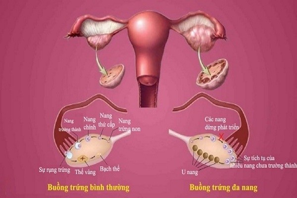 da-nang-buong-trung