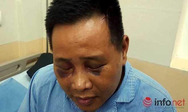 ngoi uong ca phe voi ban gai nguoi dan ong bi danh chan thuong so nao 1.jpg