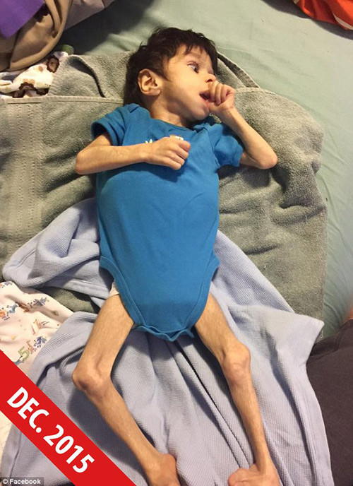 cau be 7 tuoi chi nang 36kg bi bo doi 7 nam lien trong trai tre mo coi gio ra sao 2.jpg