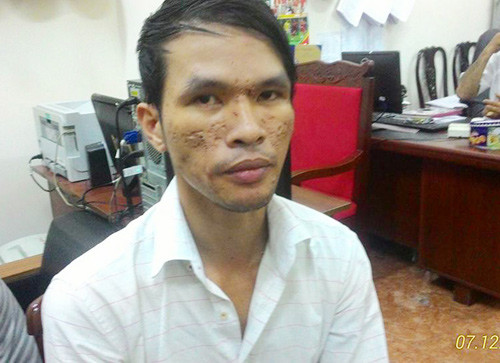 tin moi vu hanh ha be trai bang roi dien khoi to dung cam 4.jpg