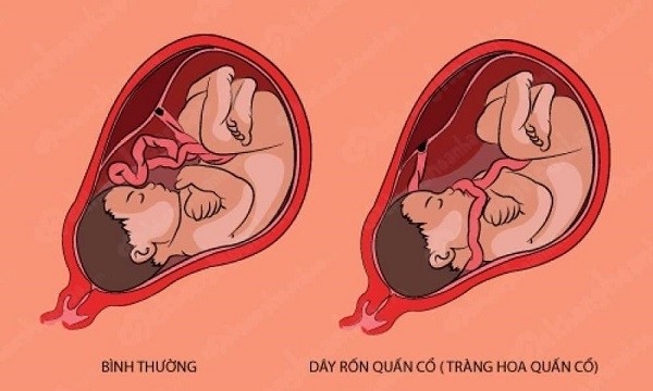 day ron quan co