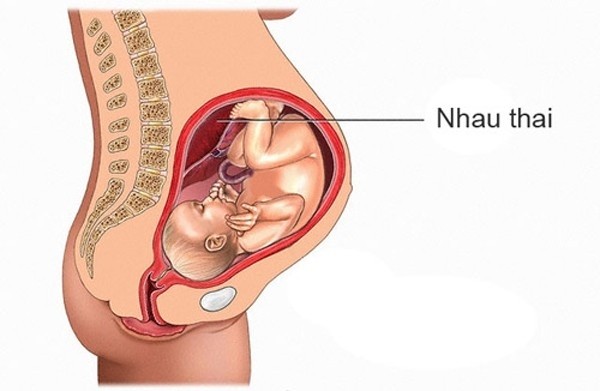 nhau thai