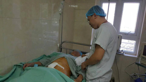 hai hung vien soi nang hon nua kg nam trong bang quang benh nhan 1.jpg